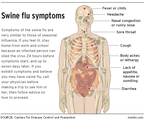 SWINE FLU SYMPTOMS: